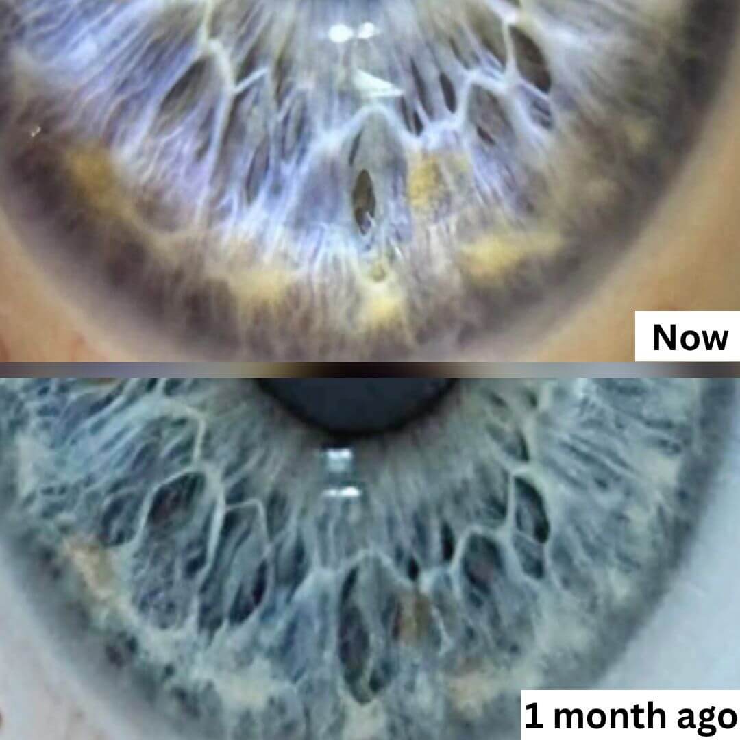 Ready to Discover What Your Eyes Reveal?